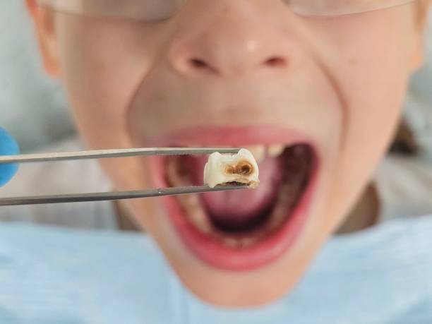Best Knocked-Out Tooth Emergency  in Fairview, TX